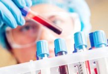 Al principio, los Centros para el Control y Prevención de Enfermedades (CDC) en Atlanta era la única instalación en los Estados Unidos autorizada para realizar pruebas para el virus.
