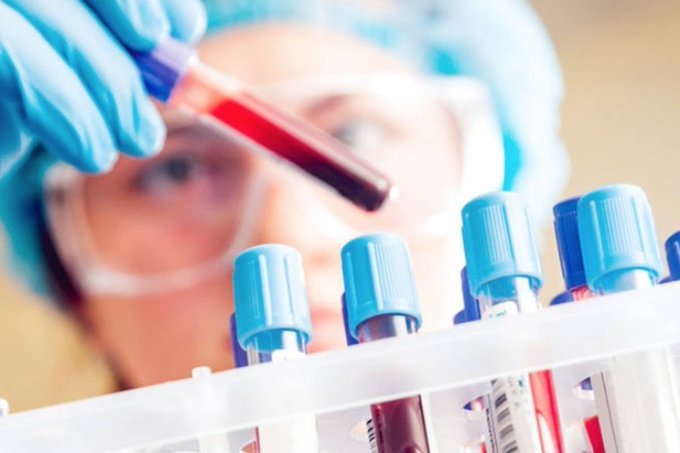 Al principio, los Centros para el Control y Prevenci&oacute;n de Enfermedades (CDC) en Atlanta era la &uacute;nica instalaci&oacute;n en los Estados Unidos autorizada para realizar pruebas para el virus.