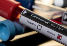 Nueva York eleva a 33 los casos de coronavirus y 4.000 personas en cuarentena Cuomo explicó que se han detectado 9 nuevos casos, todos ellos vinculados con un brote aparecido en el condado de Westchester, al norte de la ciudad de Nueva York.
