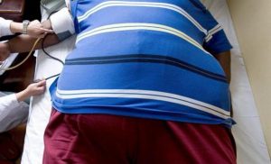 La obesidad es una enfermedad que no tiene cura y por ello tendr&iacute;a que ser tratada a la par de otros padecimientos como el c&aacute;ncer o la diabetes, dijo este viernes una experta.