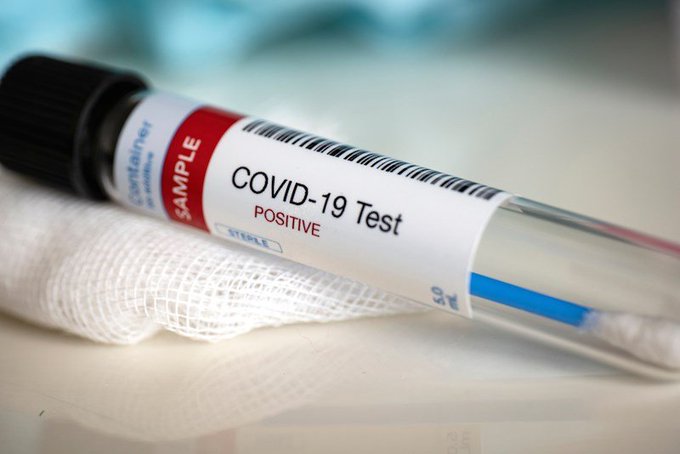 La pandemia de COVID-19 podría costarle a Estados Unidos hasta unos 654.000 millones de dólares en costos derivados de hospitalizaciones, ventiladores y otros recursos para el cuidado de la salud.