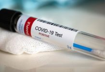 La pandemia de COVID-19 podría costar miles de millones de dólares La pandemia de COVID-19 podría costarle a Estados Unidos hasta unos 654.000 millones de dólares en costos derivados de hospitalizaciones, ventiladores y otros recursos para el cuidado de la salud.