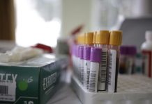 Nueva prueba promete hallar a infectados de COVID-19 que no se enfermaron Las pruebas de anticuerpos COVID-19, que se obtienen por un pinchazo en el dedo, buscan determinar si las personas desarrollaron los anticuerpos IgM e IgG.