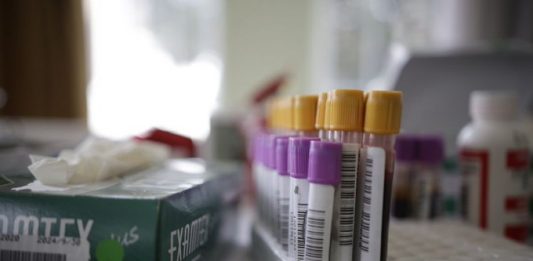 Las pruebas de anticuerpos COVID-19, que se obtienen por un pinchazo en el dedo, buscan determinar si las personas desarrollaron los anticuerpos IgM e IgG.
