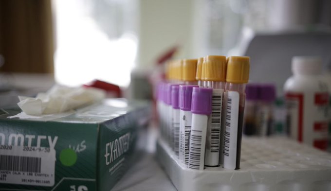 Las pruebas de anticuerpos COVID-19, que se obtienen por un pinchazo en el dedo, buscan determinar si las personas desarrollaron los anticuerpos IgM e IgG.