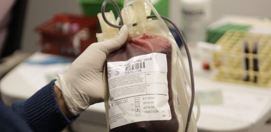 La terapia con plasma de pacientes recuperados de la COVID-19 es la "única" opción disponible actualmente para enfrentar la pandemia en EE.UU. mientras se desarrolla una vacuna