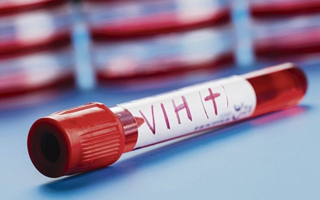 Científicos del Instituto de Investigación del Sida y de la Universidad de Miami descubrieron un nuevo tipo de células del sistema inmunitario que actúa como reservorio del VIH