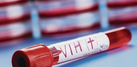 Científicos del Instituto de Investigación del Sida y de la Universidad de Miami descubrieron un nuevo tipo de células del sistema inmunitario que actúa como reservorio del VIH