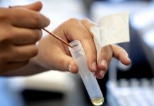 Las tensiones sobre el acceso a tests complican el debate económico en EE.UU. Las tensiones entre algunos estados y el Gobierno federal de Estados Unidos sobre el suministro de pruebas de coronavirus se colaron este lunes en el Congreso