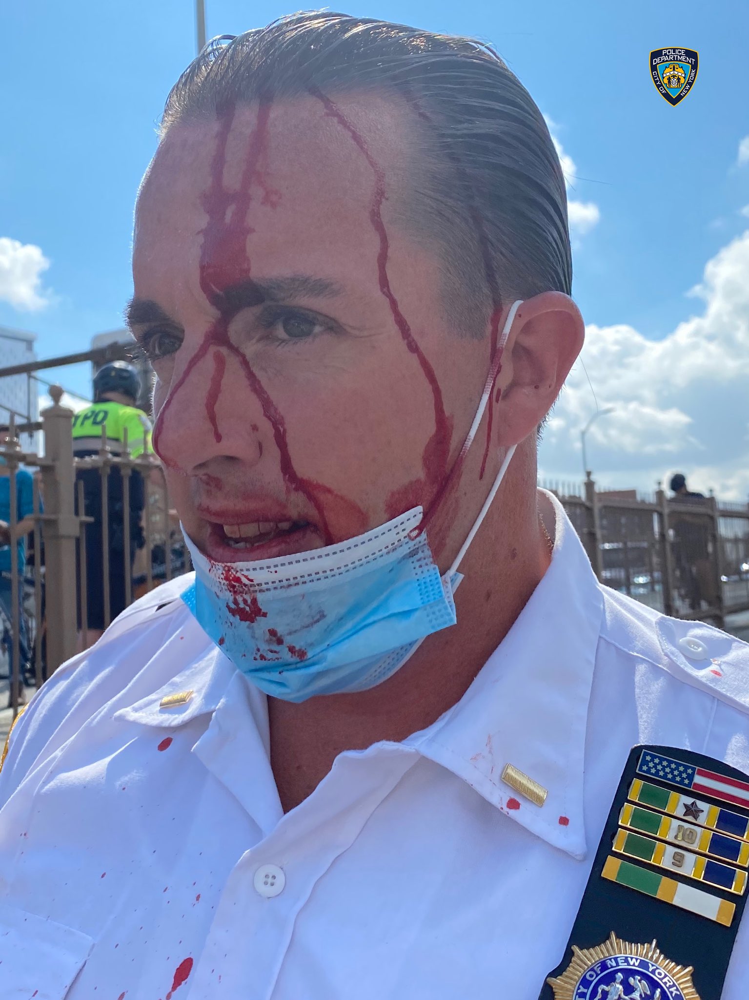 Jefe de Departamento de Polic&iacute;a de Nueva York es herido en nuevos disturbios.