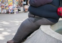 Epidemia de la obesidad.