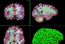 Proyecto sobre desarrollo cerebral sigue con 12.000 niños bajo observación desarrollo cerebral