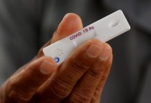 Anticuerpos en pacientes de COVID-19.