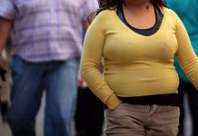 la obesidad