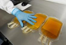 Terapia con plasma de convalecientes puede disminuir la gravedad de covid-19 plasma