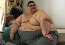 El mexicano que fue el más obeso del mundo alista reconstrucción de su cuerpo Juan Pedro Franco
