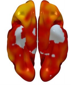 cerebro