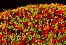 Un paso más hacia una posible solución para la diabetes células