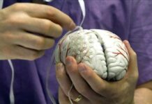 cerebro