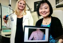 Kim Phuc, "la niña del napalm", recibe tratamiento reconstructivo en Miami