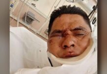 Repartidor de comida recibe brutal golpiza por robarle su bicicleta
