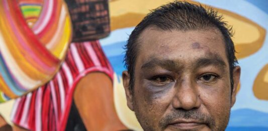 Una crisis humanitaria, así se puede calificar la llegada de inmigrantes en busca de asilo político a la ciudad de Nueva York.