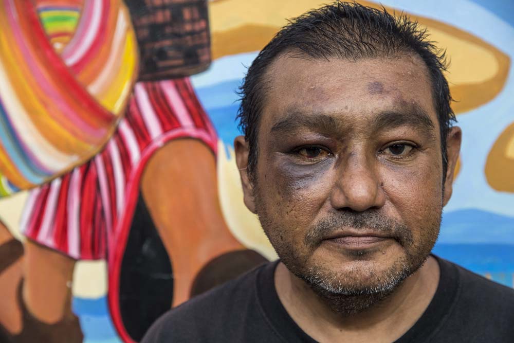 Inmigrante Una crisis humanitaria, así se puede calificar la llegada de inmigrantes en busca de asilo político a la ciudad de Nueva York.