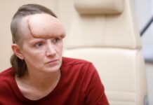 Conseguir atención médica es una lotería para enfermos de cáncer sin seguro Kaiser Health News