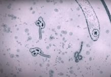 La Organización Mundial de la Salud (OMS) recomendó hoy mantener la vigilancia frente al brote de la enfermedad de Marburgo, un tipo de fiebre hemorrágica que se ha declarado en Guinea Ecuatorial y Tanzania, pero agregó que no se justifica ninguna restricción de viaje o comercio con estos países.