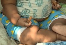 Los niños latinos en el país tienen la tasa más alta de sobrepeso y los afroamericanos la de obesidad, condiciones vinculadas a la discriminación racial, según un estudio que publica este martes la revista JAMA Network Open.