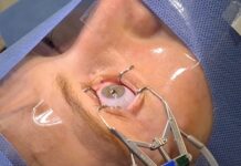 Un equipo de científicos ha logrado desarrollar un sistema con inteligencia artificial (IA) para detectar enfermedades como el párkinson analizando la edad molecular del ojo humano, según un estudio publicado este jueves en la revista especializada Cell.