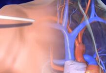 Los hospitales que atienden a minorías tienen menos recursos para tratamiento del cáncer Por ejemplo, añadió, “el acceso al equipo PET/CT desempeña un papel crucial en el diagnóstico preciso del cáncer y su vigilancia.