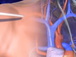 Por ejemplo, añadió, “el acceso al equipo PET/CT desempeña un papel crucial en el diagnóstico preciso del cáncer y su vigilancia.