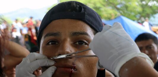 hombre mientras se cose los labios como protesta para pedir Fórmulas Migratorias Múltiples (2)