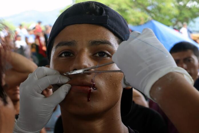 hombre mientras se cose los labios como protesta para pedir Fórmulas Migratorias Múltiples (2)