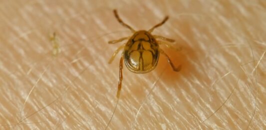 Los síntomas incluyen fiebre, cefalea y erupción, como también pueden incluir linfadenopatía, cambios en el sistema nervioso central como confusión o rigidez de nuca, mialgias y artralgias, hepatitis, vómitos e inestabilidad cardiovascular.