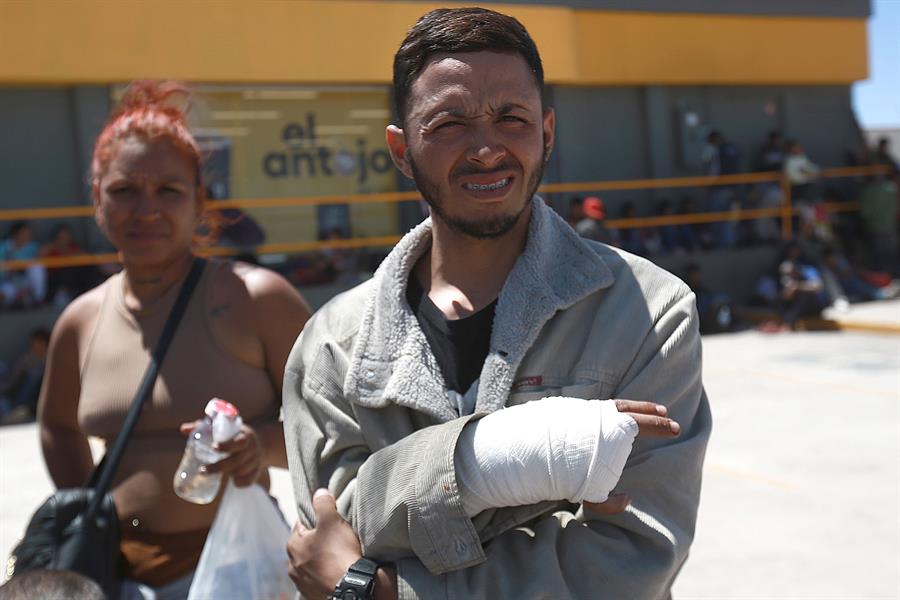 El migrante venezolano Carlos Meza (i) muestra su mano lesionada (1)