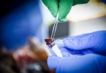 prueba de laboratorio