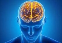 cerebro
