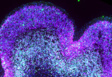 Describen cómo el síndrome de Down altera el desarrollo del cerebro antes de nacer