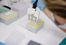 Madrid comienza a realizar pruebas de detección de la viruela del mono
